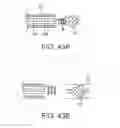 Fig. 24 - SYSTEMS AND METHODS FOR DELIVERING FLOW RESTRICTIVE ELEMENT TO AIRWAY IN LUNGS