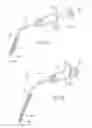 Fig. 22 - Devices, systems, and methods to fixate tissue within the regions of the body, such as the pharyngeal conduit