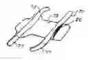 Fig. 01 - Pressure ulcer prosthesis and method for treating and/or preventing pressure ulcers