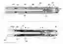 Fig. 01 - Single trip horizontal gravel pack and stimulation system and method