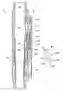 Fig. 01 - Downhole flow control apparatus, operable via surface applied pressure