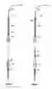 Fig. 04 - Method and apparatus to complete a well having tubing inserted through a valve