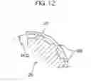 Fig. 13 - Electric power steering apparatus