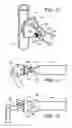 Fig. 09 - Scaffold Support Bracket and Assembly