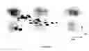 Fig. 01 - Planar electrochromatography/thin layer chromatography separations systems
