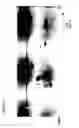 Fig. 03 - Planar electrochromatography/thin layer chromatography separations systems