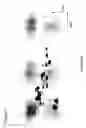 Fig. 04 - Planar electrochromatography/thin layer chromatography separations systems