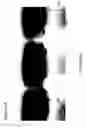 Fig. 05 - Planar electrochromatography/thin layer chromatography separations systems