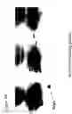 Fig. 06 - Planar electrochromatography/thin layer chromatography separations systems