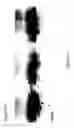 Fig. 07 - Planar electrochromatography/thin layer chromatography separations systems