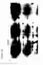 Fig. 08 - Planar electrochromatography/thin layer chromatography separations systems