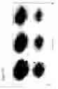 Fig. 09 - Planar electrochromatography/thin layer chromatography separations systems