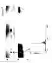 Fig. 11 - Planar electrochromatography/thin layer chromatography separations systems