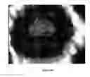 Fig. 25 - Three dimensional dielectrophoretic separator and methods of use