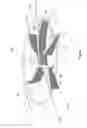 Fig. 05 - Arc-resistant microwave susceptor assembly