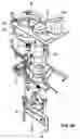 Fig. 17 - Metering and dispensing closure