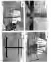 Fig. 11 - Hitch Assembly