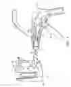 Fig. 03 - Angled surgical fastener apparatus