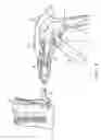 Fig. 05 - Angled surgical fastener apparatus
