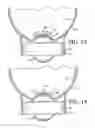 Fig. 13 - Rotating blade aircraft control system