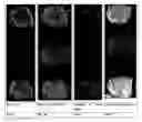 Fig. 02 - Fingerprint analysis using mass spectrometry