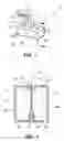 Fig. 02 - Method for supporting an electrode