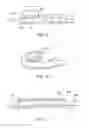 Fig. 05 - Semiconductor device and manufacturing method thereof