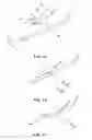 Fig. 02 - Method of forming barbs on a suture and apparatus for performing same
