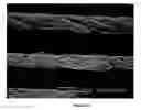Fig. 05 - Non-metallic brush seals