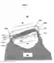 Fig. 04 - Bag holder