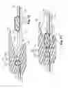 Fig. 10 - Vehicle window interior shade assembly