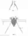 Fig. 03 - Potential separation for filling level radar