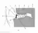 Fig. 04 - Loop antenna for in the ear audio device