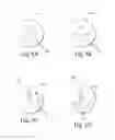 Fig. 05 - Three-channel camera systems with non-collinear apertures