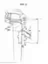 Fig. 16 - Endoscope system