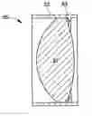 Fig. 01 - Lens assembly for vitreoretinal surgery