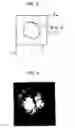 Fig. 04 - Ocular fundus portion analyzer and ocular fundus portion analyzing method
