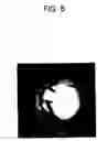 Fig. 05 - Ocular fundus portion analyzer and ocular fundus portion analyzing method