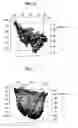 Fig. 06 - Ocular fundus portion analyzer and ocular fundus portion analyzing method