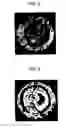 Fig. 07 - Ocular fundus portion analyzer and ocular fundus portion analyzing method