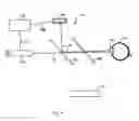 Fig. 07 - Method and device for determining the distance from a measurement point on a tissue surface of the eye