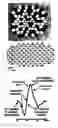Fig. 01 - Mapping retinal function using corneal electrode array