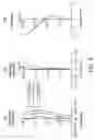 Fig. 07 - Subminiature optical system