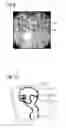 Fig. 06 - Method for displaying a devise in a 3-D image of a volumetric data set