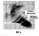 Fig. 07 - System comprising an automated tool and appertaining method for hearing aid design