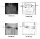 Fig. 02 - Automatic detection and correction of non-red eye flash defects