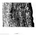 Fig. 10 - Specific binding molecules for scintigraphy, conjugates containing them and therapeutic method for treatment of angiogenesis
