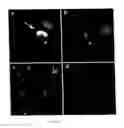 Fig. 12 - Specific binding molecules for scintigraphy, conjugates containing them and therapeutic method for treatment of angiogenesis