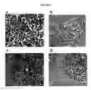 Fig. 03 - Cytotoxicity mediation of cells evidencing surface expression of CD44
