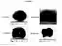 Fig. 07 - Cytotoxicity mediation of cells evidencing surface expression of CD44